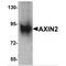 Axin 2 antibody, MBS150049, MyBioSource, Western Blot image 
