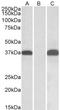 Pim-2 Proto-Oncogene, Serine/Threonine Kinase antibody, LS-B10471, Lifespan Biosciences, Western Blot image 