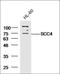 MAU2 Sister Chromatid Cohesion Factor antibody, orb186079, Biorbyt, Western Blot image 