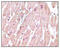 Troponin I3, Cardiac Type antibody, STJ98433, St John