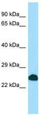 Sodium Channel Modifier 1 antibody, TA337991, Origene, Western Blot image 