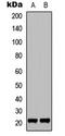 p21 antibody, GTX32376, GeneTex, Western Blot image 