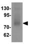 TRNA-YW Synthesizing Protein 1 Homolog antibody, GTX31441, GeneTex, Western Blot image 