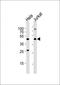 HR Lysine Demethylase And Nuclear Receptor Corepressor antibody, orb2697, Biorbyt, Western Blot image 