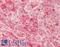 Granulin Precursor antibody, LS-B14618, Lifespan Biosciences, Immunohistochemistry paraffin image 