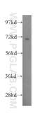 Protein Phosphatase 2 Regulatory Subunit B'Delta antibody, 12068-1-AP, Proteintech Group, Western Blot image 