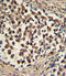 Snail Family Transcriptional Repressor 1 antibody, abx025183, Abbexa, Western Blot image 