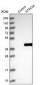 5'-Nucleotidase, Cytosolic IIIA antibody, PA5-56052, Invitrogen Antibodies, Western Blot image 