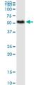 Phosphoribosylaminoimidazole Carboxylase And Phosphoribosylaminoimidazolesuccinocarboxamide Synthase antibody, H00010606-M01, Novus Biologicals, Western Blot image 