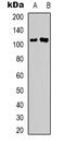 DLG Associated Protein 1 antibody, abx133625, Abbexa, Western Blot image 