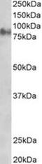 Junction Plakoglobin antibody, PA5-18064, Invitrogen Antibodies, Western Blot image 