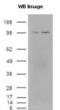 Kinesin Family Member 11 antibody, NB500-181, Novus Biologicals, Western Blot image 