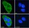 Leucine Rich Repeat Kinase 2 antibody, 45-848, ProSci, Immunofluorescence image 