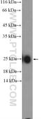 Immunoglobulin Kappa Variable 1-5 antibody, 11781-1-AP, Proteintech Group, Western Blot image 