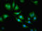 Carbonic Anhydrase 1 antibody, LS-C318090, Lifespan Biosciences, Immunofluorescence image 