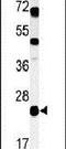 Chromosome 16 Open Reading Frame 54 antibody, PA5-24693, Invitrogen Antibodies, Western Blot image 