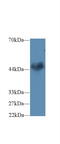 Ciliary Neurotrophic Factor Receptor antibody, MBS2006087, MyBioSource, Western Blot image 