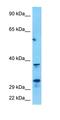 Mab-21 Like 2 antibody, orb324993, Biorbyt, Western Blot image 