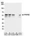 6-Phosphofructo-2-Kinase/Fructose-2,6-Biphosphatase 2 antibody, A304-286A, Bethyl Labs, Western Blot image 