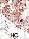Protein Inhibitor Of Activated STAT 1 antibody, abx026813, Abbexa, Immunohistochemistry frozen image 
