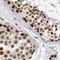 Protein Phosphatase 1 Regulatory Subunit 8 antibody, NBP1-90112, Novus Biologicals, Immunohistochemistry paraffin image 