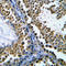 DNA Topoisomerase II Beta antibody, LS-C352951, Lifespan Biosciences, Immunohistochemistry frozen image 