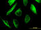 Tubulin Alpha 1a antibody, LS-C198502, Lifespan Biosciences, Immunofluorescence image 