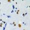 Nucleolar Protein Interacting With The FHA Domain Of MKI67 antibody, orb382451, Biorbyt, Immunohistochemistry paraffin image 