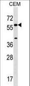 Cytochrome P450 Family 21 Subfamily A Member 2 antibody, LS-C167211, Lifespan Biosciences, Western Blot image 