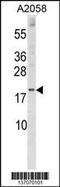 Sorting Nexin 3 antibody, 59-911, ProSci, Western Blot image 