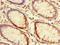 Family With Sequence Similarity 131 Member A antibody, LS-C377829, Lifespan Biosciences, Immunohistochemistry paraffin image 
