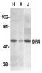 TNF Receptor Superfamily Member 10a antibody, GTX74228, GeneTex, Western Blot image 