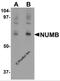 NUMB Endocytic Adaptor Protein antibody, 6311, ProSci, Western Blot image 