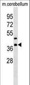 CRK Like Proto-Oncogene, Adaptor Protein antibody, LS-C158188, Lifespan Biosciences, Western Blot image 