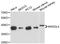 Killer cell immunoglobulin-like receptor 2DL4 antibody, A12836, ABclonal Technology, Western Blot image 