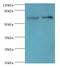 Baculoviral IAP Repeat Containing 2 antibody, MBS1499284, MyBioSource, Western Blot image 