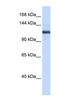 Phospholipase A2 Group IVB antibody, NBP1-80305, Novus Biologicals, Western Blot image 