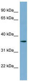 Proton Activated Chloride Channel 1 antibody, TA342366, Origene, Western Blot image 