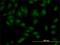 SET Domain Containing 7, Histone Lysine Methyltransferase antibody, H00080854-M01, Novus Biologicals, Immunocytochemistry image 