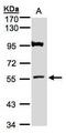 ADAMTS Like 1 antibody, PA5-28408, Invitrogen Antibodies, Western Blot image 