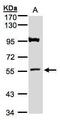 ATL1 antibody, PA5-28408, Invitrogen Antibodies, Western Blot image 