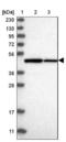TRNA Methyltransferase 12 Homolog antibody, NBP1-83633, Novus Biologicals, Western Blot image 