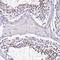 Ubiquitin Conjugating Enzyme E2 L3 antibody, NBP1-92557, Novus Biologicals, Immunohistochemistry paraffin image 