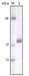 Discoidin Domain Receptor Tyrosine Kinase 2 antibody, NBP1-28883, Novus Biologicals, Western Blot image 