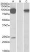 Transient Receptor Potential Cation Channel Subfamily V Member 3 antibody, TA311578, Origene, Western Blot image 