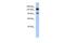 Poly(ADP-Ribose) Polymerase Family Member 10 antibody, PA5-42250, Invitrogen Antibodies, Western Blot image 