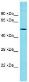 Keratin 38 antibody, TA332025, Origene, Western Blot image 