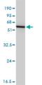 Glutathione Synthetase antibody, H00002937-M03, Novus Biologicals, Western Blot image 