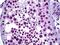 WT1 Transcription Factor antibody, 70-015, ProSci, Immunohistochemistry frozen image 