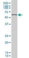 Kruppel Like Factor 11 antibody, H00008462-M02, Novus Biologicals, Western Blot image 